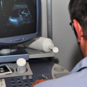 In vito Fertilisation